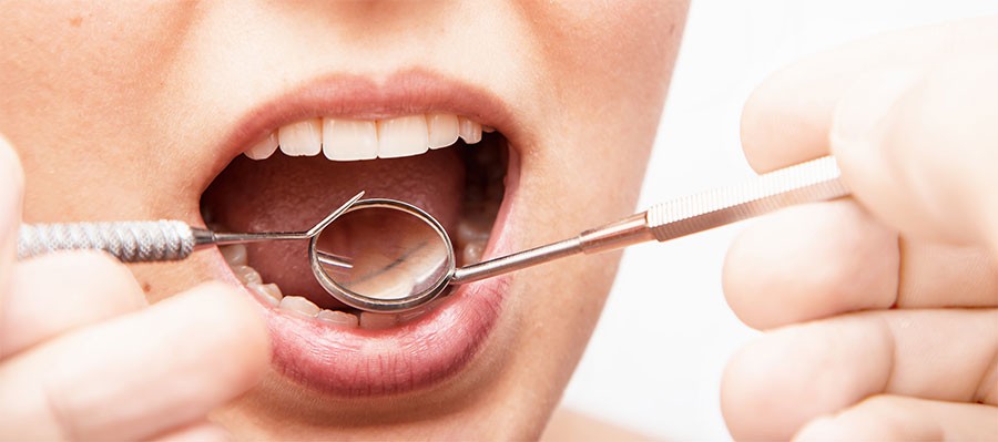 consejos-evitar-periodontitis